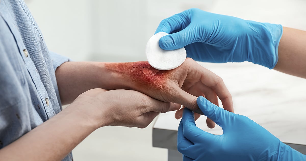 Chấn thương bàn tay