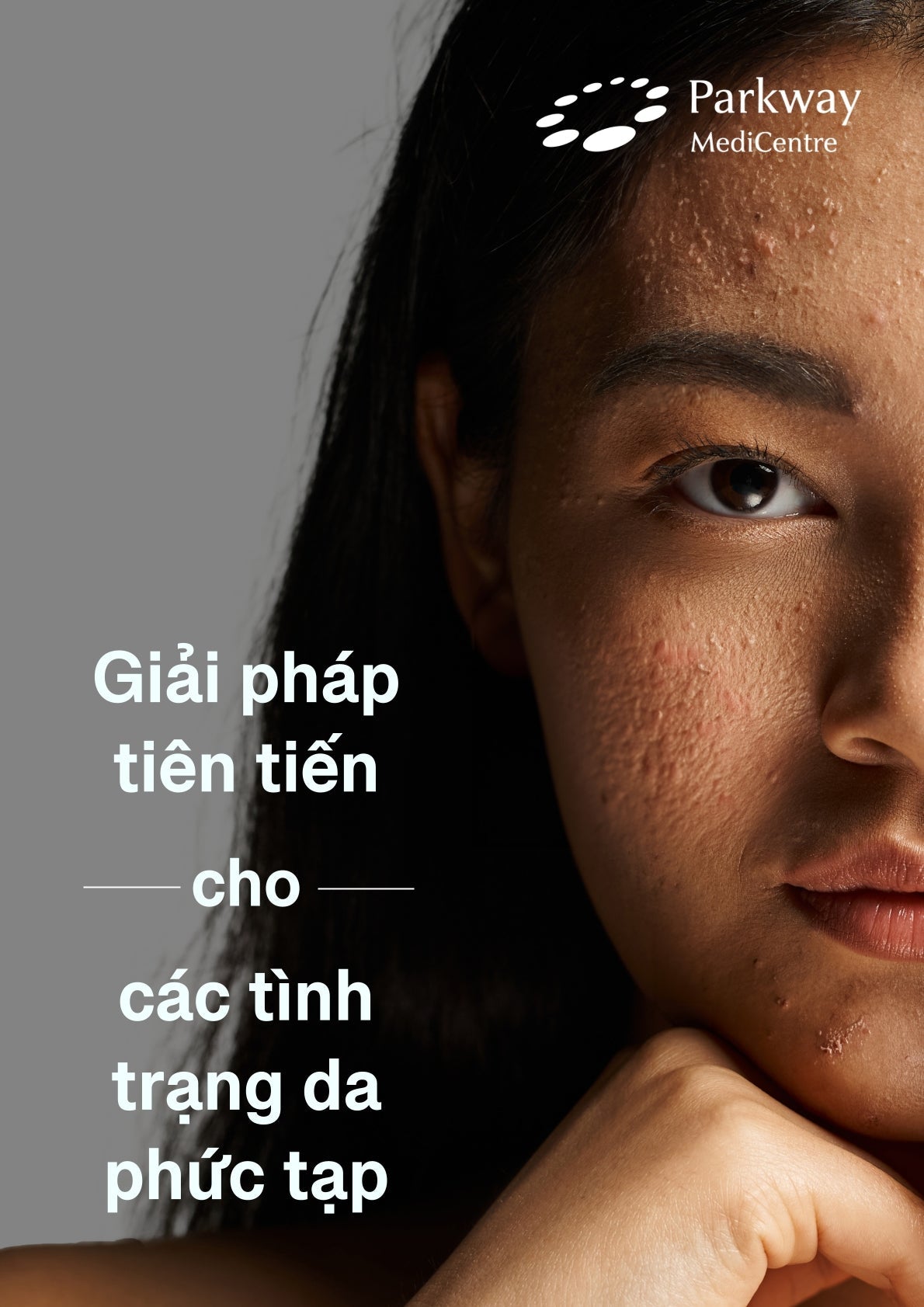 Parkway - giải pháp tiên tiến cho các tình trạng da phức tạp