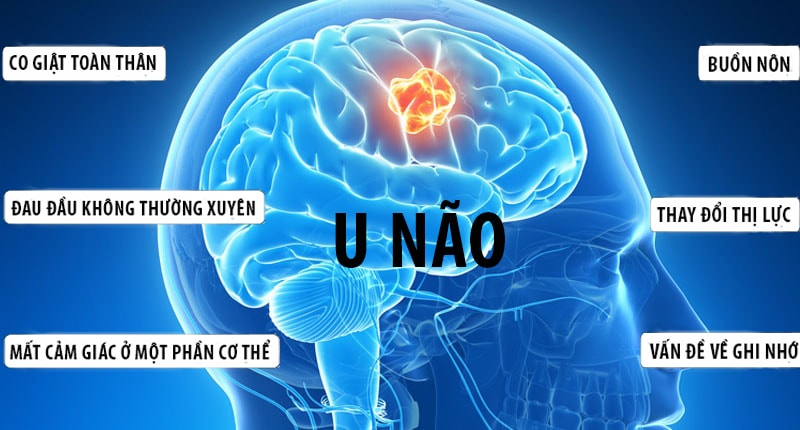 U não