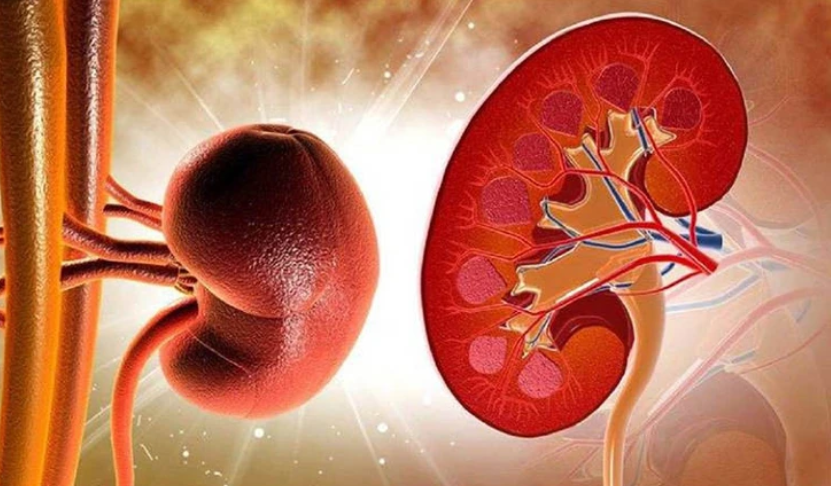 Viêm cầu thận
